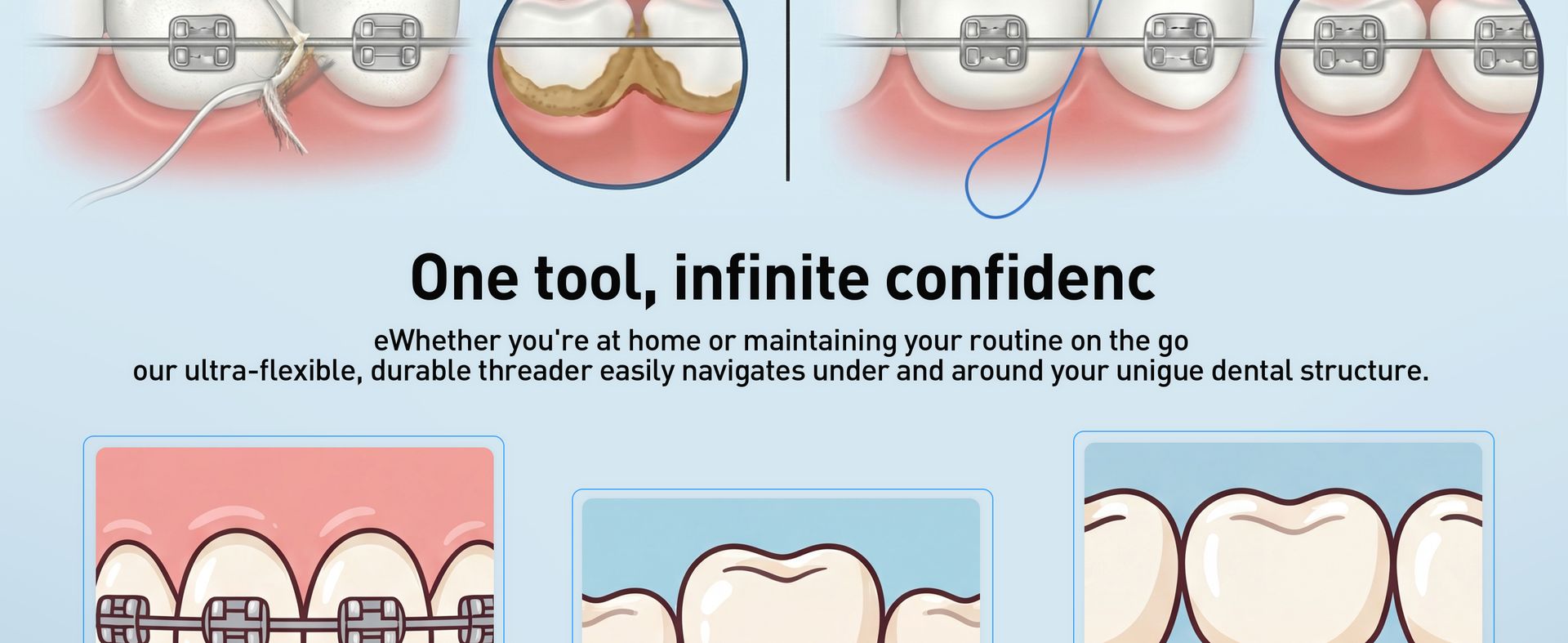 RAZOKO Dental Floss Threaders for Braces & Orthodontic Care