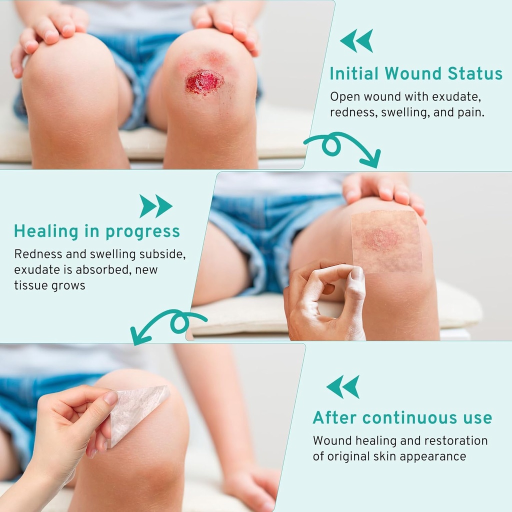 upadated-hydrocolloid-bandages12ft-hydro-3.jpg