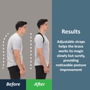 comfybrace-posture-corrector-back-brace--2.jpg