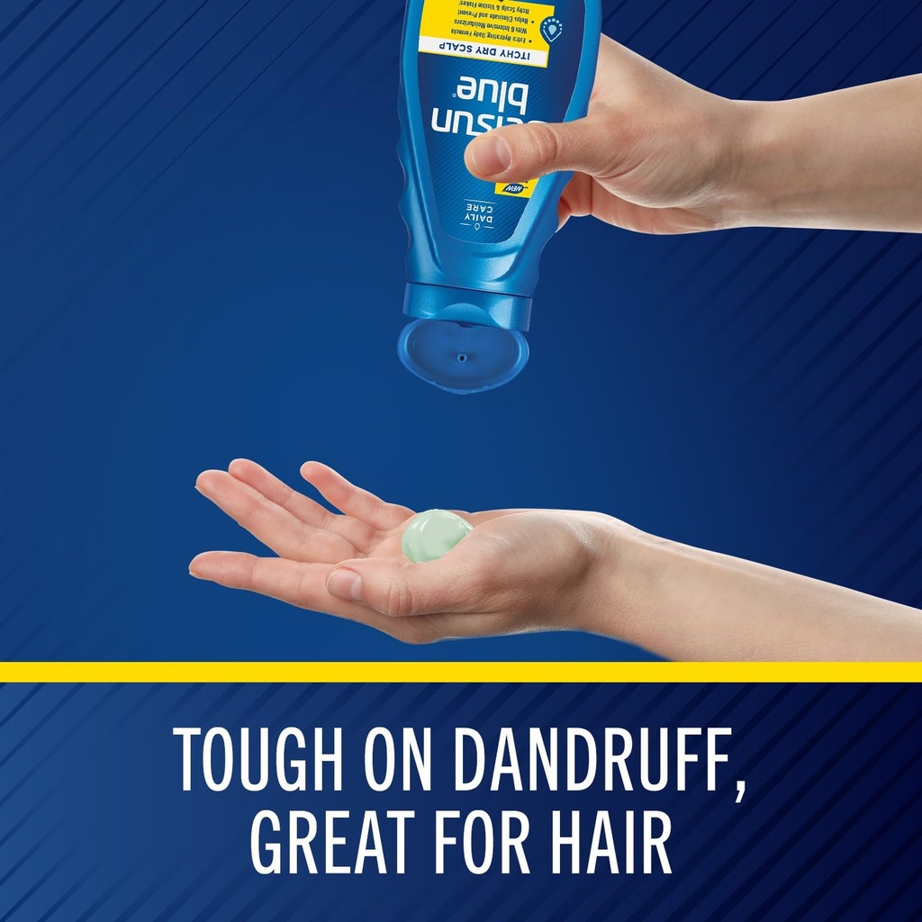 selsun-blue-itchy-dry-scalp-antidandruff-61+iw7nawuL.jpg