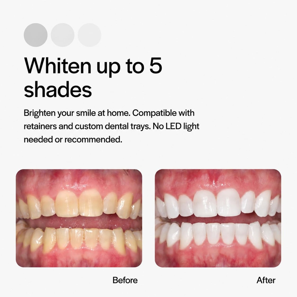 opalescence-35-teeth-whitening-gel-refil-61ddHWtteEL.jpg