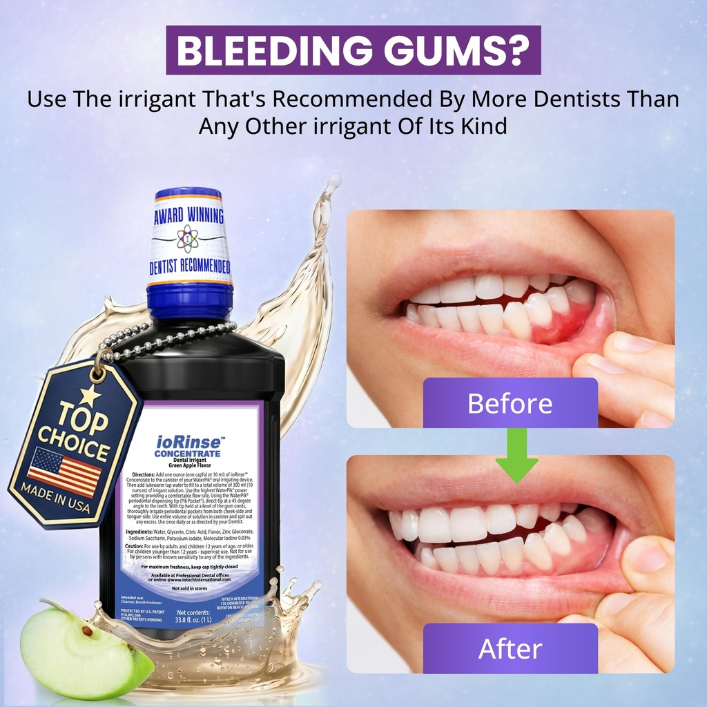 iorinse-dental-irrigant-with-molecular-i-81y3mhaVN4L.jpg