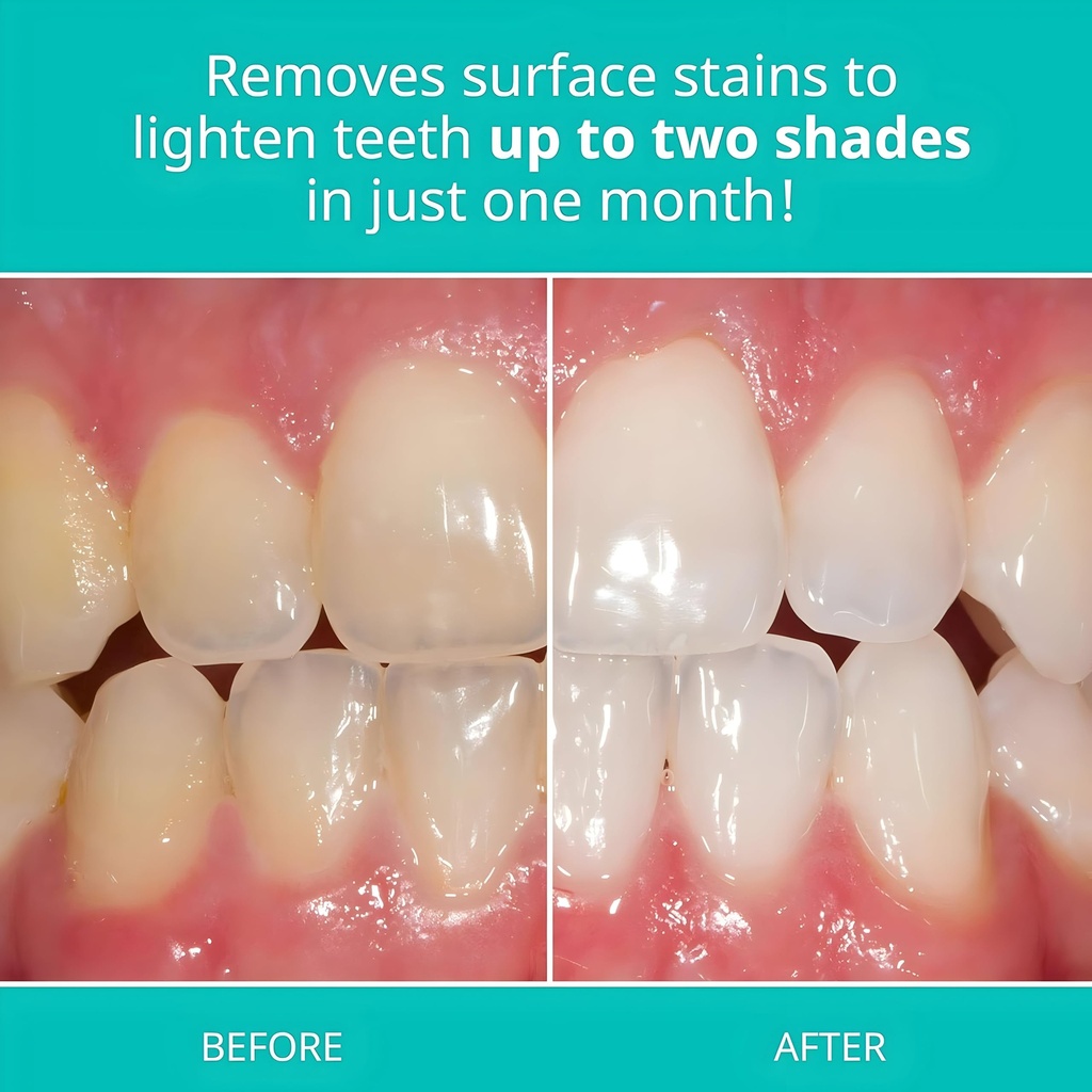 opalescence-whitening-toothpaste-origina-81PdlFmAQrL.jpg