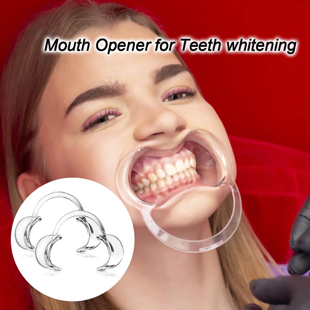 30-pack-dental-cheek-retractor-professio-61pYEJQr3fS.jpg