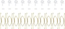 uxcell 10Pcs Plate Hanger, 4 inch universal Brass Invisible Wall Plate Hangers with 10Pcs Wall Hooks for Decorative Plates, Gold