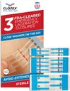 Clozex Emergency Laceration Closures - Repair Wounds Without Stitches, Skin Closure Device for 3 Individual Wounds Or Combine for Total Length of 4 1/4 Inches